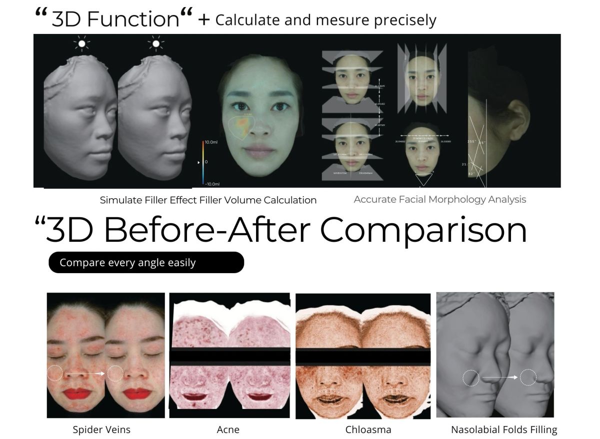 Manufacturer feature sheet: 3D functions and before-and-after comparison views