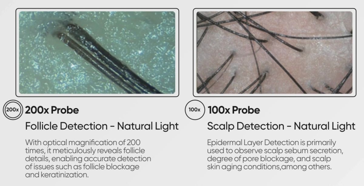 Meicet hair and scalp analyser probe imagery, 200x follicle and 100x scalp detection