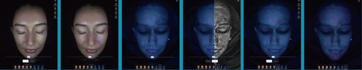 Imaging modes as presented in the MC-range consultation software