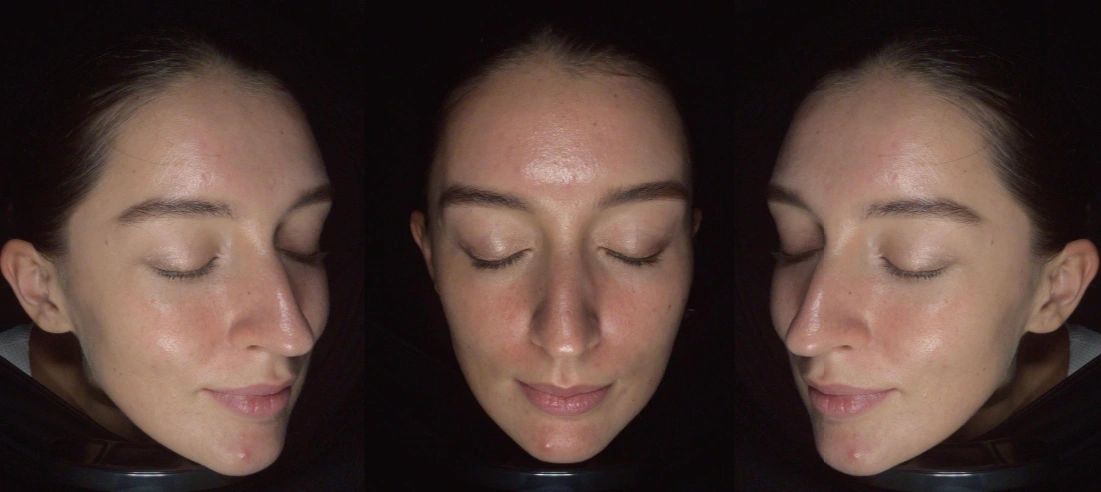 Multi-angle facial capture from the MC-range software
