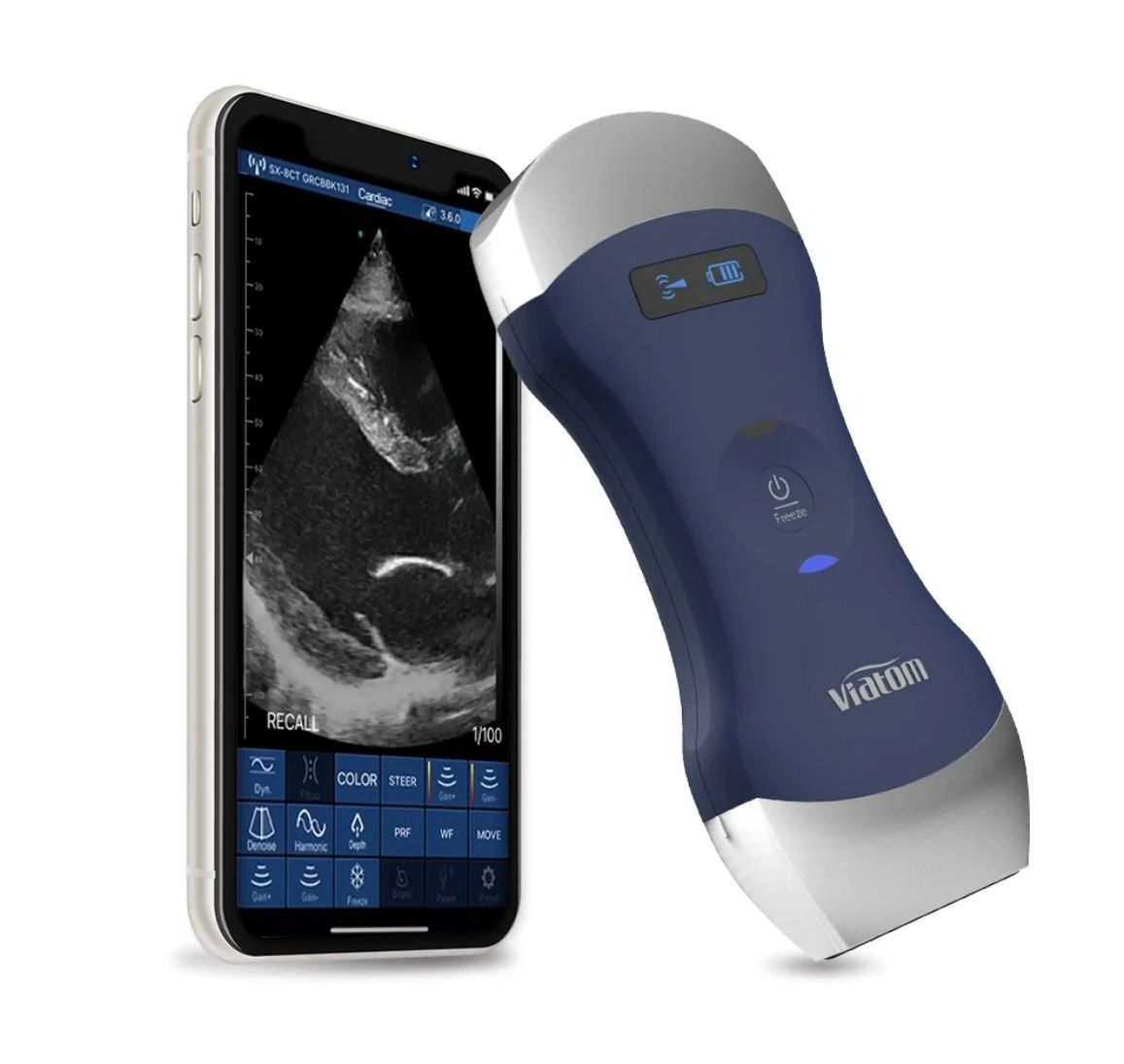 Dual-head wireless handheld ultrasound device beside a smartphone running its imaging app